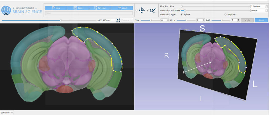 Cell Locator Interface: A cross-platform, open-source Slicer-based application co-developed with the Allen Institute for Brain Science and the BICCN. Cell Locator lets users load a 20× microscopy image of a brain slice, generate a matching virtual slice in a segmented, color-coded 3D atlas (mouse, human, or non-human primate), annotate cell soma positions, and automatically push orientation and coordinate metadata back to the Allen Institute’s LIMS—streamlining the Patch-seq pipeline and precise spatial mapping.